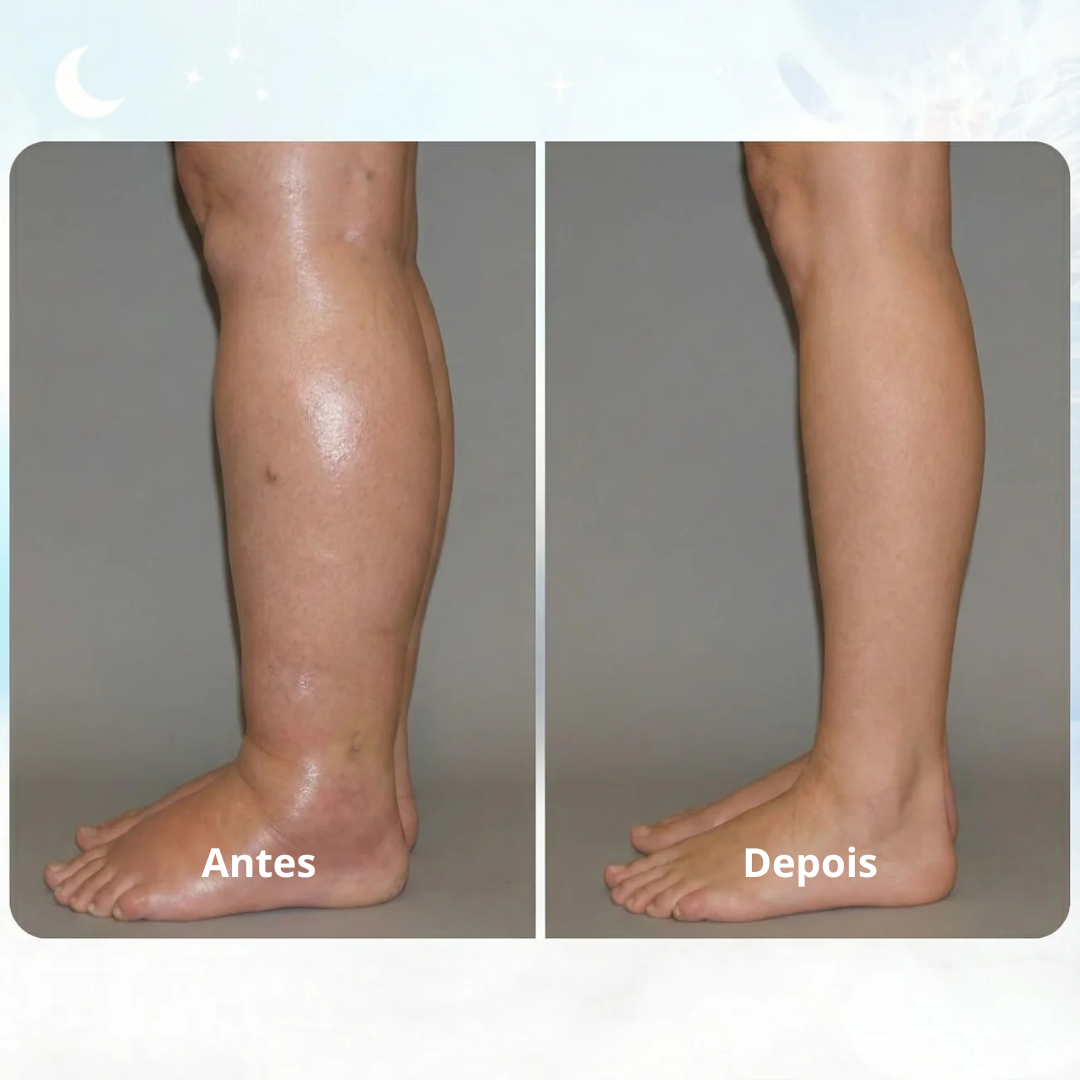 Before and After – tornozelo antes e depois